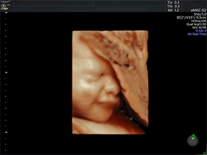 中村レディスクリニック　胎児超音波スクリーニング